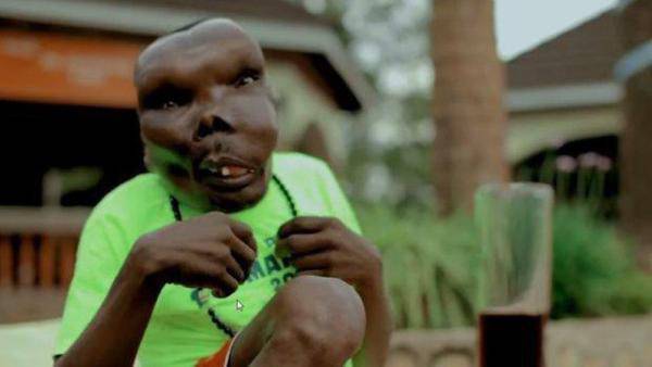 乌干达最丑男子“靠脸吃饭”