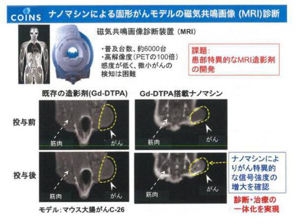 日本研发纳米胶囊 吃粒胶囊治好癌症五年内推广(2)