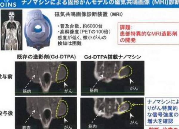 日本研发纳米胶囊 可准确杀伤癌细胞(2)