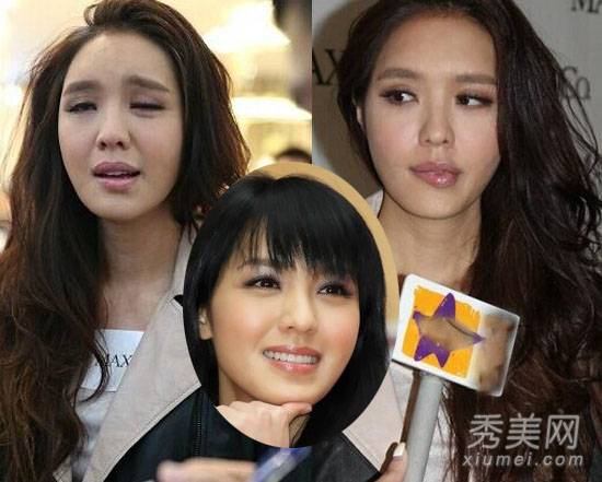 娱乐圈“假脸”泛滥 30位明星整容后脸歪嘴斜(7)