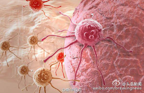 日本研发纳米胶囊 专门攻击癌细胞