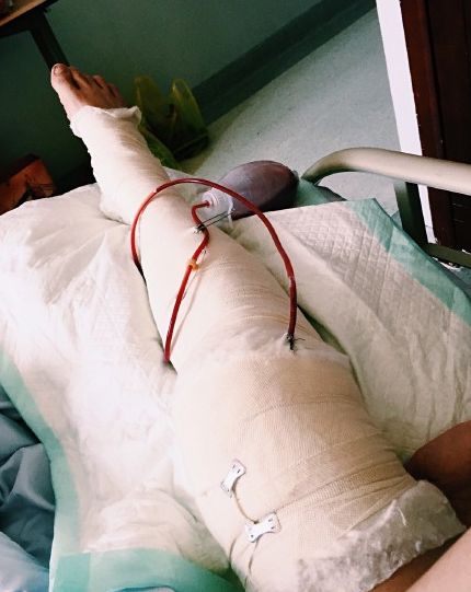 霍尊晒膝盖手术病照:手拄拐杖 面色苍白(3)