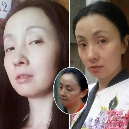 宁静周海媚林心如 “不老女神”真假素颜对决(6)