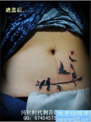女性腹部疤痕遮盖—小鸟纹身图片