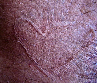 腿部皮肤划痕的心形纹身图案