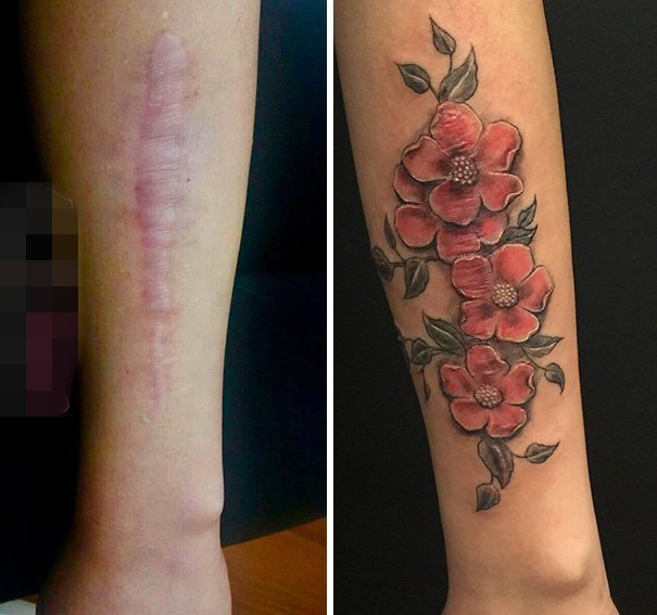 让人感动的伤疤覆盖创意个性唯美纹身图案
