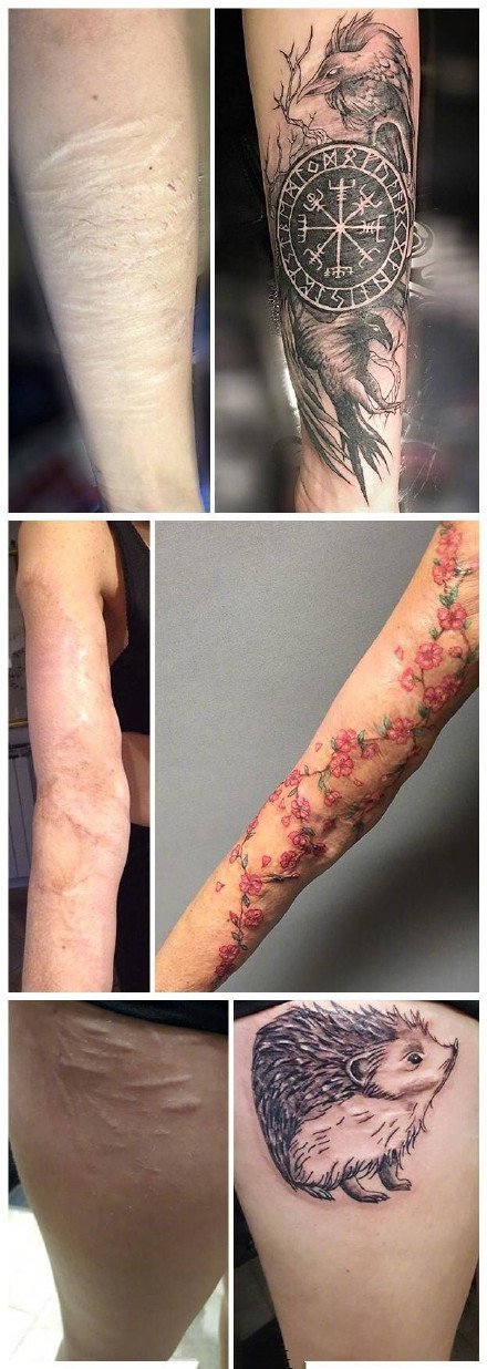 疤痕遮盖纹身--几张优秀的疤痕遮盖纹身图案案例作品欣赏