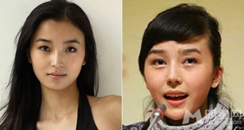 深陷整容门的女星大盘点