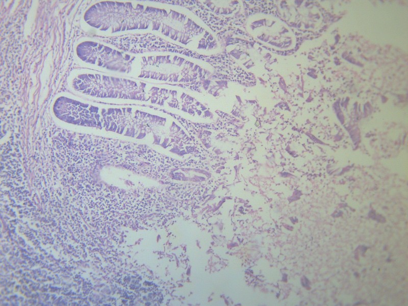 阑尾炎 显微切片图片(13张)
