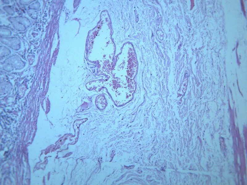 慢性萎缩性胃炎 显微切片图片(18张)