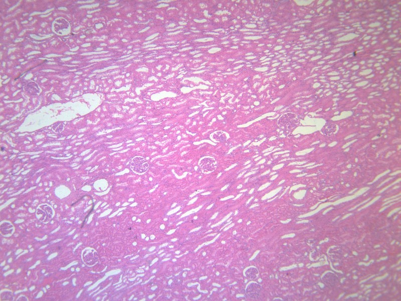 肾小管水肿 显微切片图片(11张)