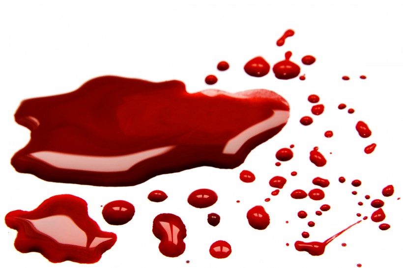 鲜红的血迹图片(15张)