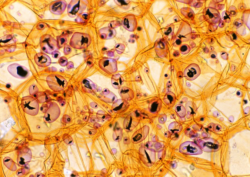 显微镜下的细胞图片(41张)