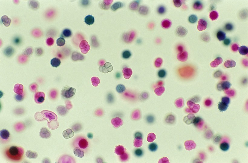 显微细胞图片(26张)