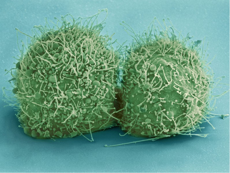 显微镜下的细菌图片(16张)