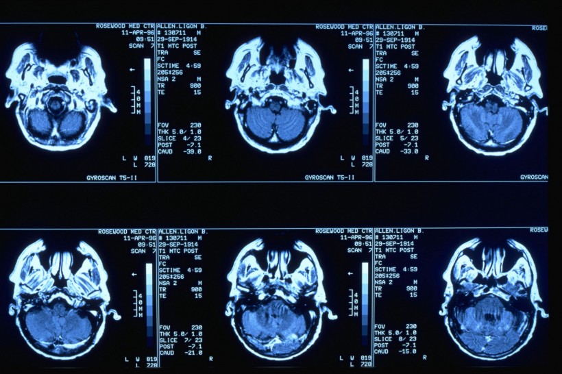 医学透视图片(100张)