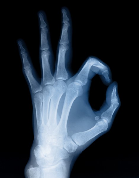 X光下的人物图片(15张)
