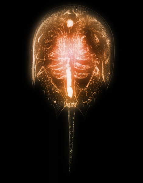 X光下的人物图片(15张)