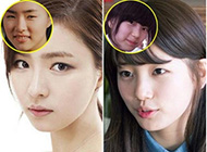 猪扒变美女！韩国新生代女星整容变脸