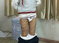 南京养母“虐童案追踪：被释放或被取保候审