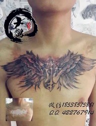 胸前十字架翅膀疤痕覆盖