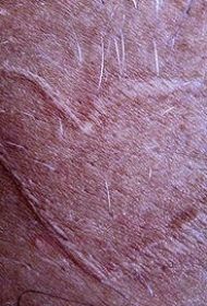 腿部皮肤划痕的心形纹身图案