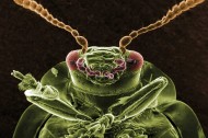 显微镜下的昆虫图片(22张)